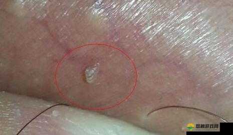二个蛋蛋摸起来里面都有疙瘩：需要引起重视并及时检查