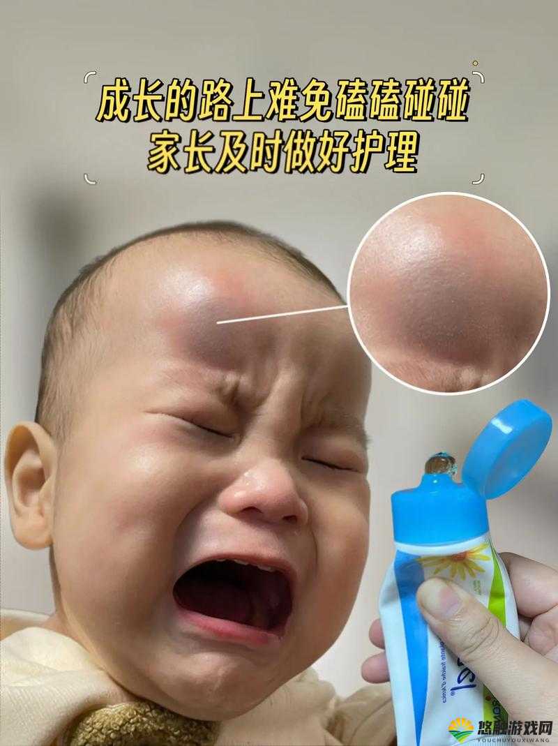 :又肿又疼的奶头:激情背后的隐痛