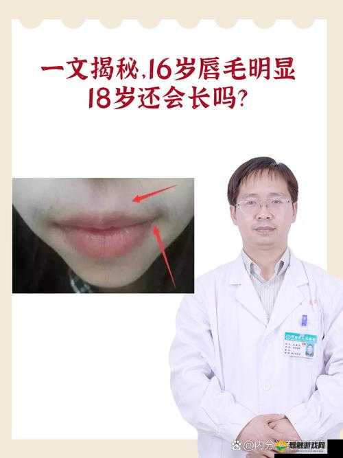 16 岁唇毛明显到 18 岁还会长吗：深入探究其生长规律及应对策略