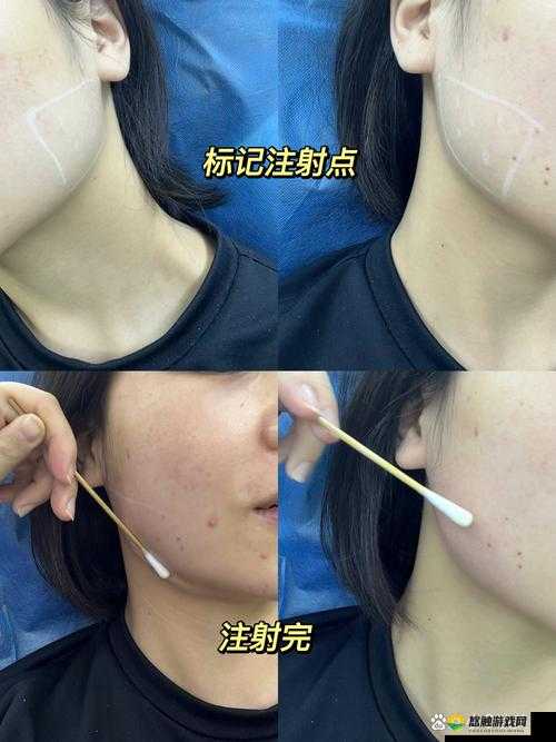 疯狂注射 V2：危险的注射行为引发的后果
