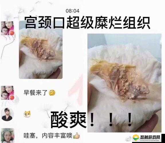 老中医用嘴排阴蝳？这究竟是真是假