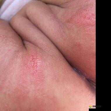 宝宝湿透还嘴硬说疼究竟是怎么回事呢