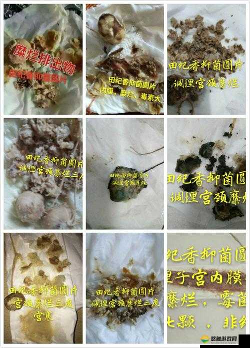 下面突然掉出来透明的一坨：探寻其背后的神秘成因