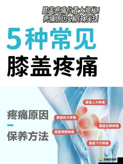姜茶C1V1骨科治疗新进展：如何有效缓解骨关节疼痛与炎症？