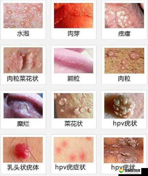 女性三角区长了个硬疙瘩，是怎么回事？