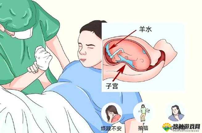 羊水栓塞是坐着分娩还是躺着分娩？
